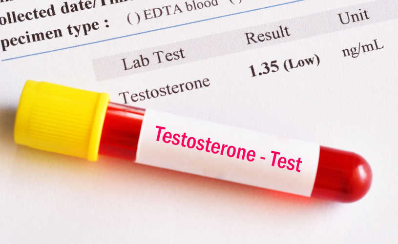 Testosteron test huisarts